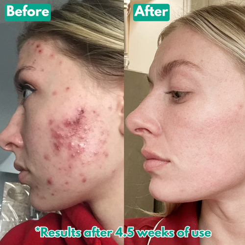 Velora Microcrystal™ Serum PM Duo | See smoother skin in just 3–5 nights