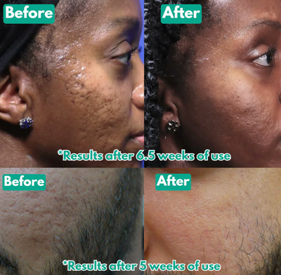 Velora Microcrystal™ Serum PM Duo | See smoother skin in just 3–5 nights