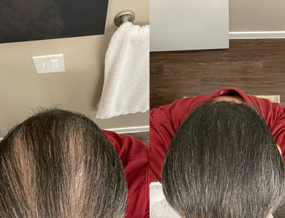 Velora Crème Densité™