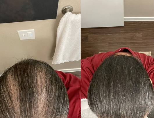 Velora Crème Densité™