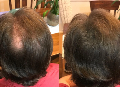 Velora Crème Densité™