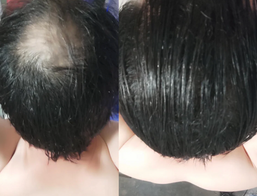Velora Crème Densité™