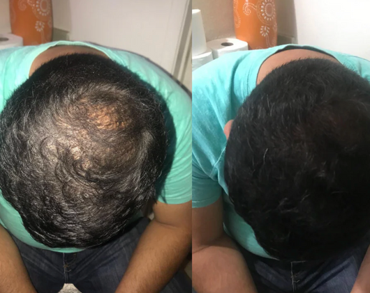 Velora Crème Densité™