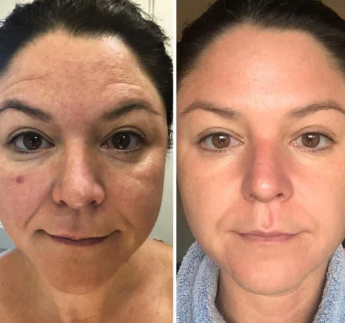 Velora PDRN Collagen Volume Balm