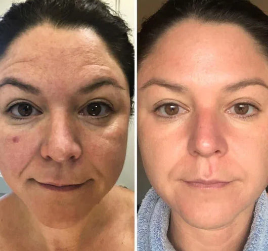 Velora PDRN Collagen Volume Balm