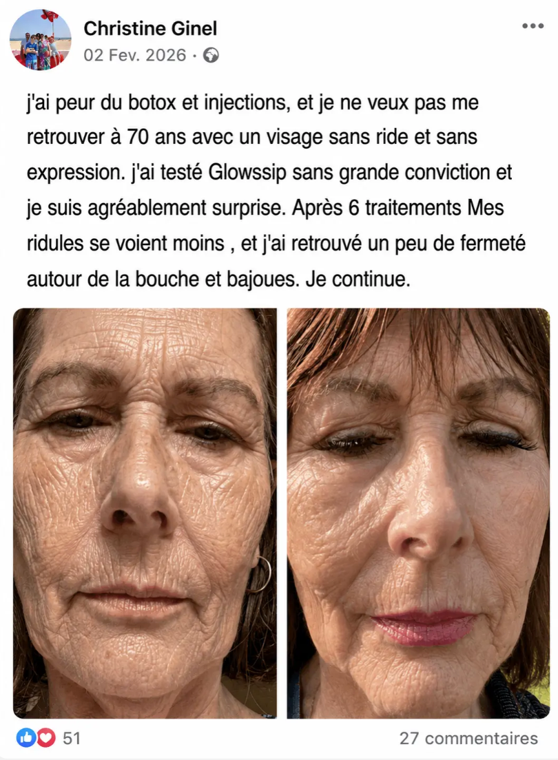 Pourquoi la peau perd du volume et ce qui fait vraiment la différence