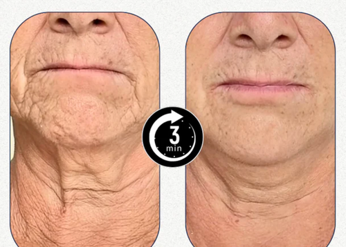 Velora™ |Effet immédiat en 3 minutes