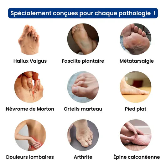 Pourquoi les sandales Velora sont différentes